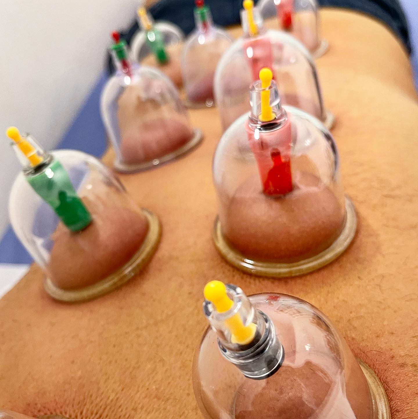 Coppettazione? Utilissima!