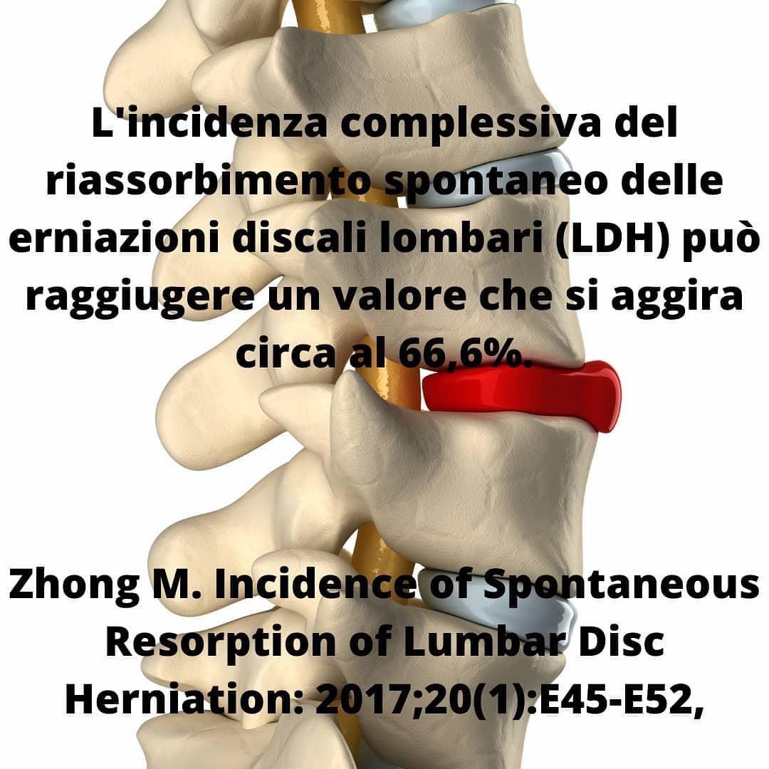 Fisioterapia per l’ernia del disco